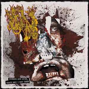 Maggots Infestation In The Aortic Valve With Intense Suppuration Resulting In Massive Mucus Obstruction - Humans Are Scum, That's Why I Eat Them mp3