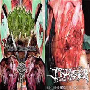 Infester / Hydropneumothorax - Hidden Medico-Pathological Inquests (Part 2) / Cerebral Tumorectomia mp3