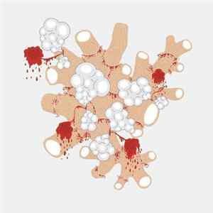 Saxon Shore - The Exquisite Death Of Saxon Shore mp3