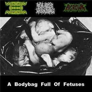 SxGxAxEx / Rectal Abscess Infection Discharge / Ingrown - A Bodybag Full Of Fetuses mp3