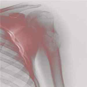 Dead Body Collection - Incomplete Fracture mp3