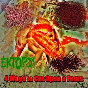 HxFxYxHxK / Agonizing Vulva / Ektopia / Enema Jizz - 4 Ways To Cut Open A Fetus mp3