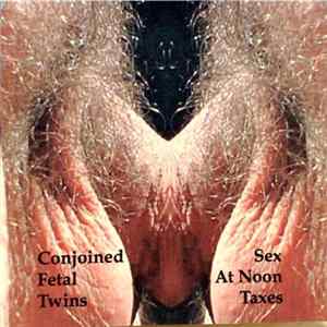 Conjoined Fetal Twins - Sex At Noon Taxes mp3