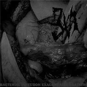 3XA - Bacterial Infection Exacerbates Gastriti mp3