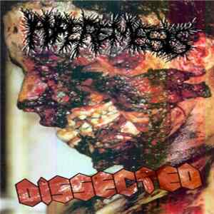 Hyperemesis / Dissected - Hyperemesis / Dissected mp3